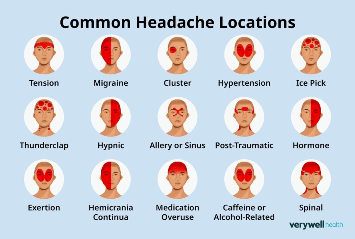 Headaches